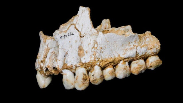 El estudio del sarro dental ha permitido conocer otros aspectos antiguos, como la automedicación de los neardentales.