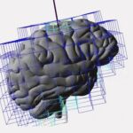 Imagen del sistema desarrollado para ayudar a los neurocirujanos