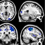 Áreas cerebrales activadas durante el procesamiento de Tarjeta de débito y Paypal / Fundación Descubre