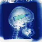 Así se alcoholiza el cerebro de un adolescente