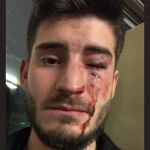 El joven tras la agresión en el metro / Foto: Twitter @OCL_H