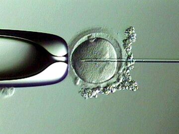 Fecundaci&oacute;n in vitro