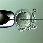 Fecundación in vitro