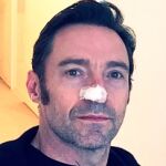 Hugh Jackman sufre una recaída de su cáncer
