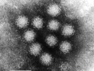 El norovirus visto al microscopio El norovirus visto al microscopio