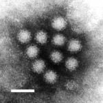 El norovirus visto al microscopio