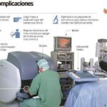 Cirugía oncológica guiada por un robot