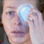 Ester Quintana perdió su ojo izquierdo por un impacto tras la manifestación de la huelga general del 14-N