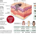 Nueva combinación de fármacos contra el melanoma
