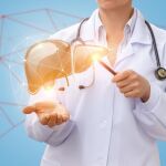 La hepatitis D se asocia con una progresión más rápida de la fibrosis, mayor riesgo de desarrollar cirrosis hepática y tasas más elevadas de cáncer de hígado y muerte
