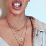 Kim Kardashian con sus accesorios dentales