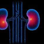 ¡Ojo con la enfermedad renal crónica en España!, una patología silenciosa y desconocida por muchos, pero que cada vez mata más