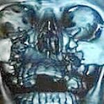 Imagen de la lesión máxilofacial de la torero Hilda Tenorio