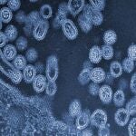 Virus de la gripe aviar