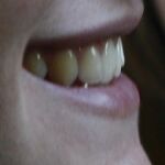 Los refrescos amenazan los dientes tanto como las drogas