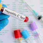 Trasplantes de órganos con hepatitis C