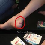 La modelo muestra su heridas