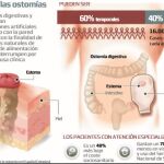 Sólo seis autonomías cumplen el ratio ideal de estomaterapeutas