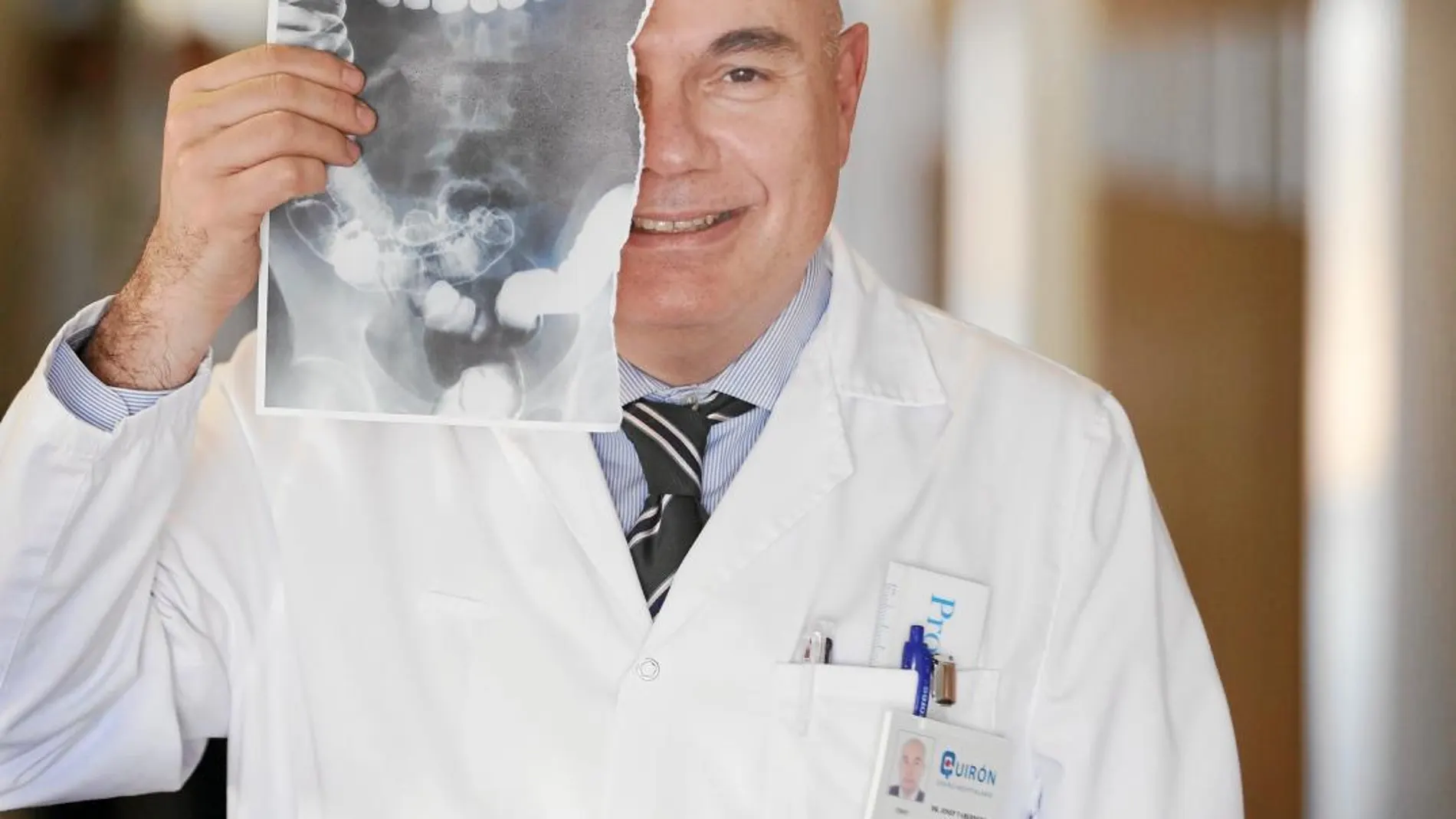 El director de Oncología del Vall d’Hebron sostiene una radiografía de colon rota. «Ya no se hacen, ahora trabajamos con colonoscopias», sonríe