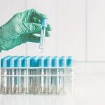 Nueva inmunoterapia contra la metastásis de pulmón y vejiga