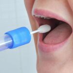 Existen test de artrosis que solo necesitan una muestra de saliva para detectar la enfermedad.