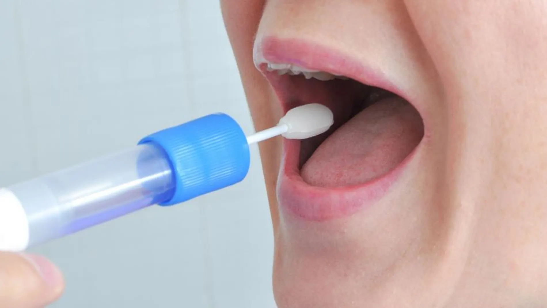 Existen test de artrosis que solo necesitan una muestra de saliva para detectar la enfermedad.