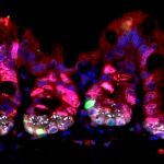 En rojo, las células altamente proliferativas del intestino, que se consideran sensibles a la radiación y mueren durante la terapia. En verde, células madre durmientes con altos niveles de proteína URI, que se vuelven proliferativas tras la radiación para regenerar el intestino dañado