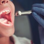 La enfermedad celiaca provoca aftas recurrentes | Dreamstime