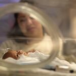 El número de partos prematuros ha aumentado en los últimos años