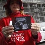 Una de las voluntarias de Derecho a Vivir muestra una ecografía a las puertas del Congreso