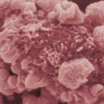 Composición de imágenes microscópicas de células cancerígenas.
