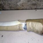Imagen de la pierna ortopédico con las bolssas de cocaína pegadas
