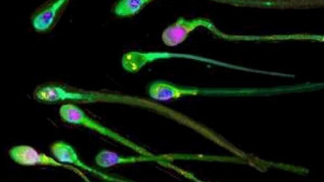 El estrés deja una huella duradera en el esperma