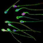 El estrés deja una huella duradera en el esperma