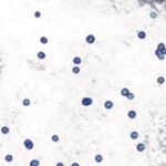Aditivo alimentario común encontrado para afectar la microbiota intestinal