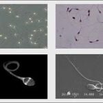 Imágenes de espermatozoides