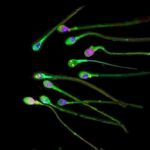 La primera carrera de espermatozoides del mundo se ha celebrado en Los Ángeles