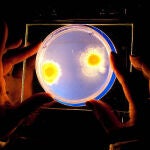 Mycobacterium colombiense