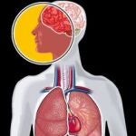 ¿Por qué es tan letal el ébola?