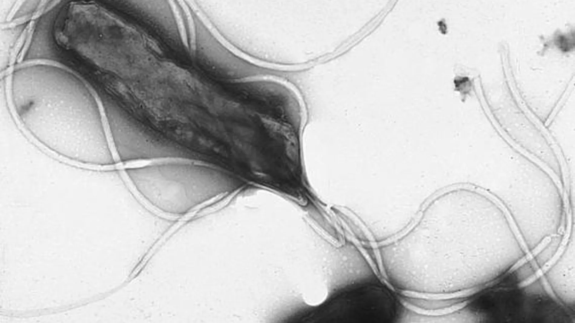 La bacteria Helicobacter pylori