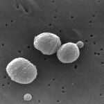 Antibióticos más eficaces contra el neumococo