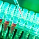 La posibilidad de hacer estudios genómicos a gran escala permite conocer en detalle el perfil molecular específico de los tumores