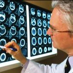 Un médico analiza las consecuencias del alzhéimer en una radiografía