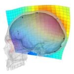 Los cambios en las áreas parietales de nuestra especie pueden haber creado una situación de vulnerabilidad a la neurodegeneración, como ocurre en los procesos asociados con la enfermedad de Alzheimer