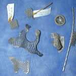 Implantes de titanio poroso