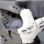 Reconstruyen la cara de un paciente gracias a un sistema de impresión en 3D