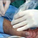 España está al «primer nivel» mundial en cirugía de mano