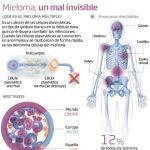 Más supervivencia en el mieloma múltiple en recaída
