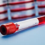 Una muestra de sangre