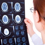 Descifran nuevas relaciones entre cerebro y apetito